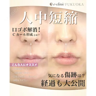 eクリニック 福岡院 伊藤 渉医師の症例