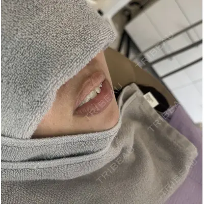 nico wellness デンタルクリニック広尾 あかり医師の症例