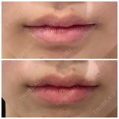 しのぶ皮膚科 蘇原しのぶ医師の症例