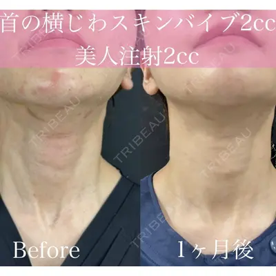 ルラ美容クリニック 渋谷本院 昼間 路子医師の症例