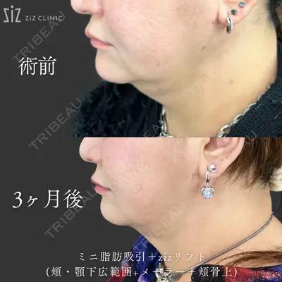 ziz CLINIC 村岡 史子医師の症例