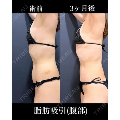 HAAB×DREAM BEAUTY CLINIC 東京本院 吉岡 修一医師の症例