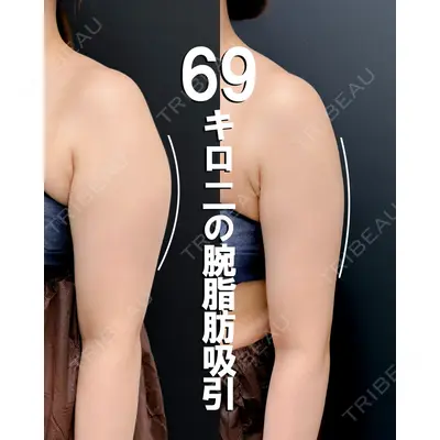 湘南美容クリニック 渋谷院 小草 智之医師の症例