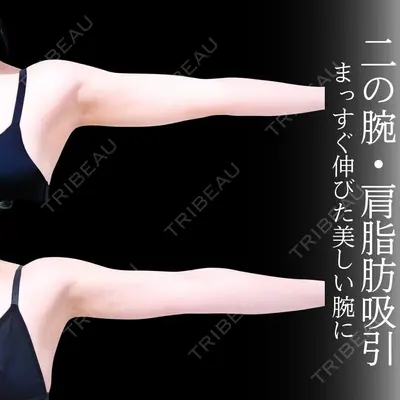 アリエル美容クリニック 横浜院 加藤 敏次医師の症例