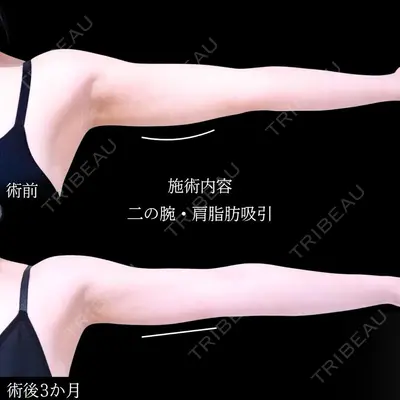 アリエル美容クリニック 横浜院 加藤 敏次医師の症例
