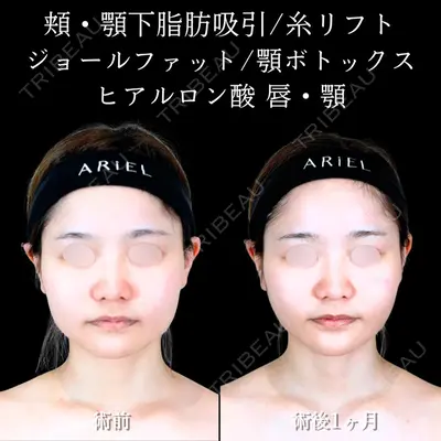アリエル美容クリニック 横浜院 渡邉 光医師の症例