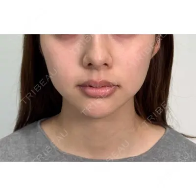 Moon Beauty Clinic 渡邉 正士医師の症例