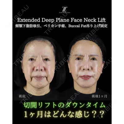 Zetith Beauty Clinic 新宿院 副島直人医師の症例
