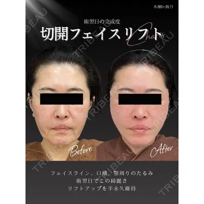 CHARIS BEAUTY CLINICの症例