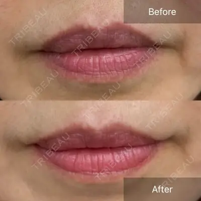 CHARIS BEAUTY CLINIC 木畑智哲医師の症例