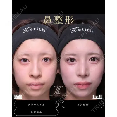 Zetith Beauty Clinic 福岡院 羽根 和秀医師の症例