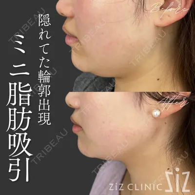 ziz CLINIC 村岡 史子医師の症例