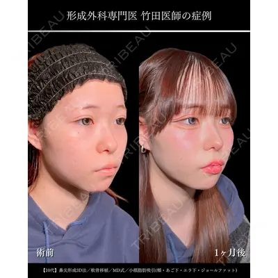 東京シンデレラ美容外科 大宮院 竹田 昌平医師の症例
