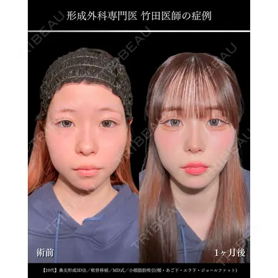 東京シンデレラ美容外科 大宮院 竹田 昌平医師の症例