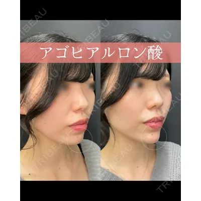 ルラライト美容クリニック 八王子院の症例