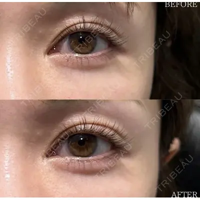 X CLINIC 恵比寿院 辻村 梢医師の症例
