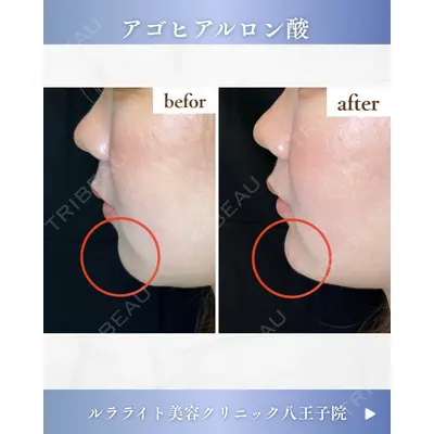 ルラライト美容クリニック 八王子院 桑野 淳医師の症例