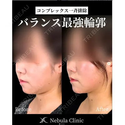 愛知春日井美容外科ネビュラクリニック 都築 諒医師の症例