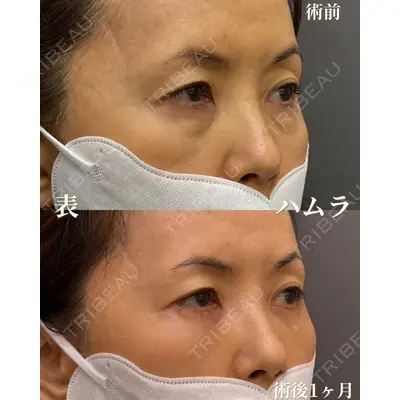 お茶の水美容形成クリニック 吉井 健吾医師の症例