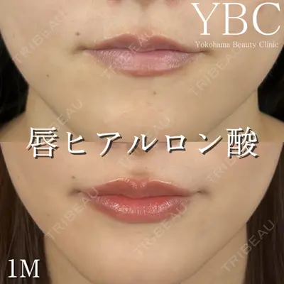 YBC横浜美容外科 立川院 大島 諒士医師の症例