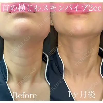 ルラ美容クリニック 渋谷本院 昼間 路子医師の症例