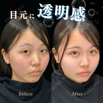 CROWN BEAUTY CLINIC 神山 豊医師の症例