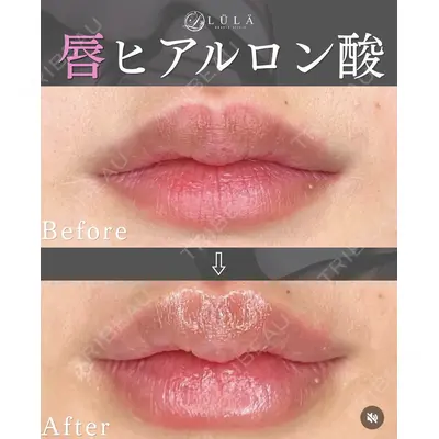 ルラ美容クリニック 静岡院の症例