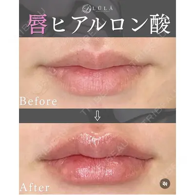 ルラ美容クリニック 静岡院の症例
