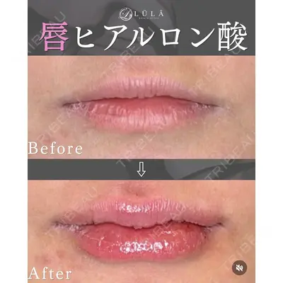 ルラ美容クリニック 静岡院の症例