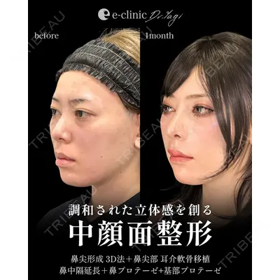 eクリニック 大阪院 八木 良太医師の症例