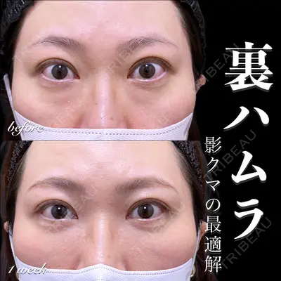 EMMO FACE CLINIC 大宮院 百瀬 直也医師の症例
