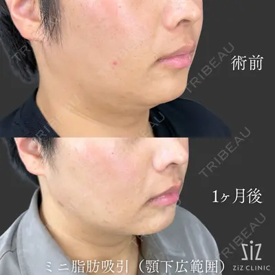 ziz CLINIC 村岡 史子医師の症例