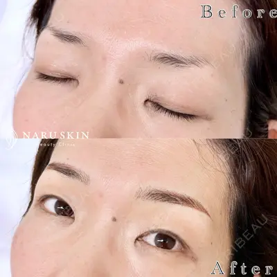 NARU Beauty Clinic 【ナルクリ】の症例