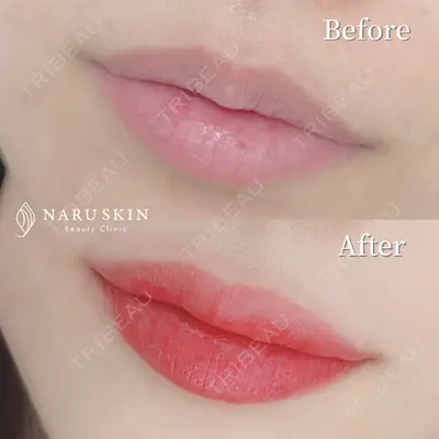 NARU Beauty Clinic 【ナルクリ】の症例