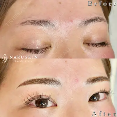 NARU Beauty Clinic 【ナルクリ】の症例