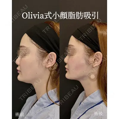 Olivia Clinic 中原 良介医師の症例