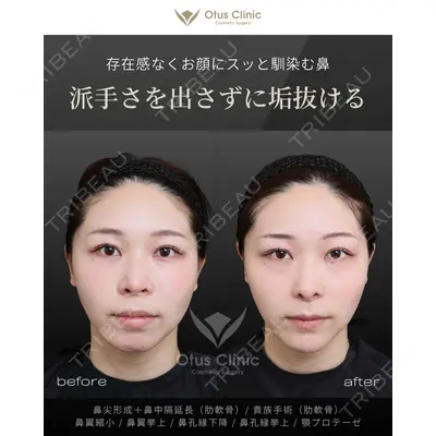 Otus Clinic 【オータスクリニック】 中 徳太郎医師の症例