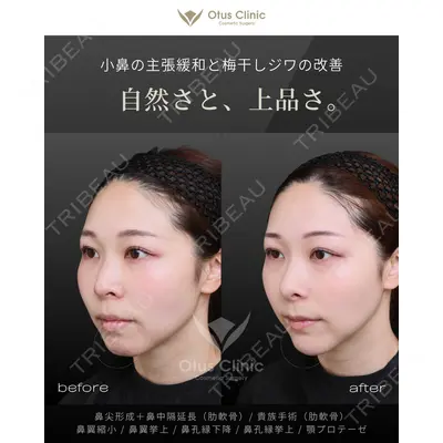 Otus Clinic 【オータスクリニック】 中 徳太郎医師の症例