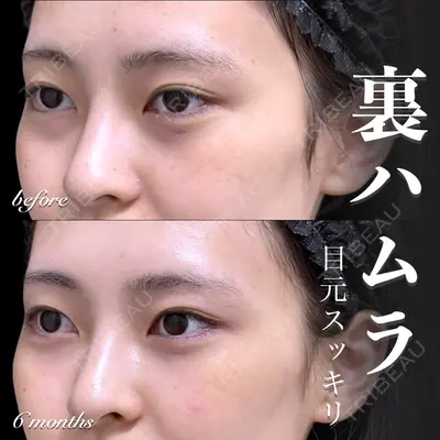 EMMO FACE CLINIC 大宮院 百瀬 直也医師の症例