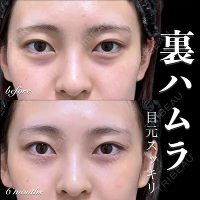 EMMO FACE CLINIC 大宮院 百瀬 直也医師の症例