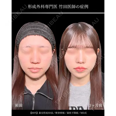 東京シンデレラ美容外科 大宮院 竹田 昌平医師の症例