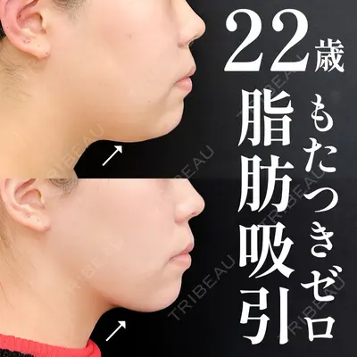 湘南美容クリニック 渋谷院 小草 智之医師の症例