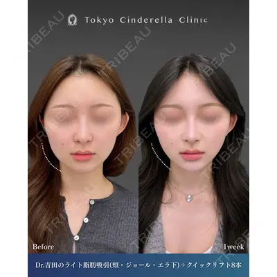 東京シンデレラ美容外科  横浜院 吉田 利之医師の症例