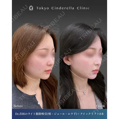 東京シンデレラ美容外科  横浜院 吉田 利之医師の症例