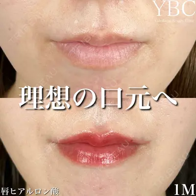 YBC横浜美容外科 池袋院 磯村 亮輔医師の症例