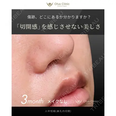 Otus Clinic 【オータスクリニック】 中 徳太郎医師の症例