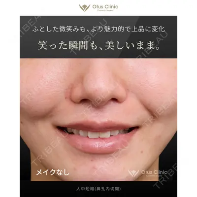 Otus Clinic 【オータスクリニック】 中 徳太郎医師の症例