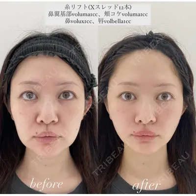 X CLINIC 恵比寿院 辻村 梢医師の症例