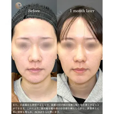eクリニック 福岡院 伊藤 渉医師の症例