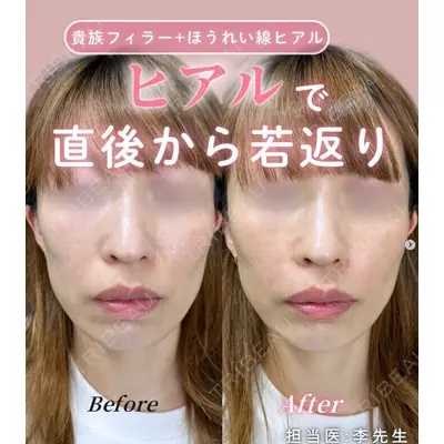 ルラ美容クリニック 神戸院の症例